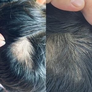 Tratamiento Capilar Avanzado con ADN para Hidratar, Calmar y Fortalecer el Cuero Cabelludo, Sérum para el Cuidado del Cabello <span class=keywords><strong>Yogoo</strong></span>, Venta al Por Mayor - Product Image 6