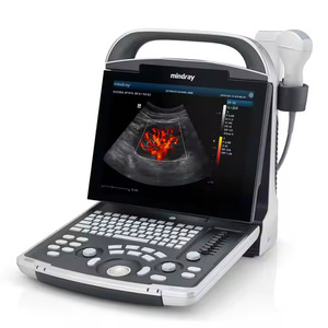 เครื่องอัลตราซาวนด์สัตวแพทย์ DP-10 สำหรับส่งออก ระบบวินิจฉัยด้วยอัลตราซาวนด์แบบดิจิทัลเต็มรูปแบบ พกพาสะดวก ภาพขาวดำ พร้อม - Product Image 1