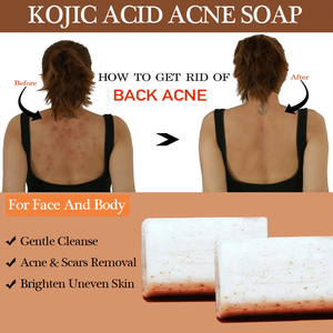 フェイスホワイトニングブリーチングピンプルダークスポットコレクター修正グローセラムリムーバーリムービングクリームボディローションソープスキンケアセット - Product Image 5