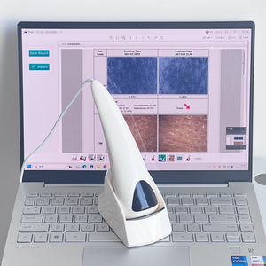 Analizador de piel 3D virtual con software italiano/francés y español con 8 informes y detección de capa de piel más profunda - Product Image 5