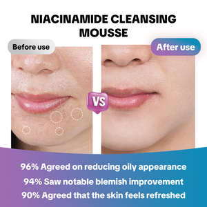 Mousse nettoyante en profondeur à la niacinamide, <span class=keywords><strong>gel</strong></span> mousse, contrôle du sébum, nettoyant visage <span class=keywords><strong>pour</strong></span> tous types de peaux, <span class=keywords><strong>pour</strong></span> adultes, marque privée - Product Image 3