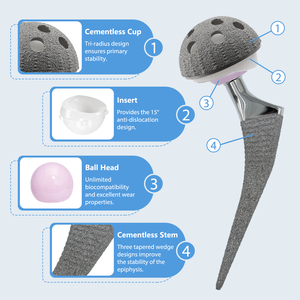 Sistema de Reemplazo <span class=keywords><strong>Total</strong></span> de Cadera Anatómico Profesional de Grado Médico Sin Cemento, Implantes Quirúrgicos de Titanio con Recubrimiento de HA para Fracturas - Product Image 3