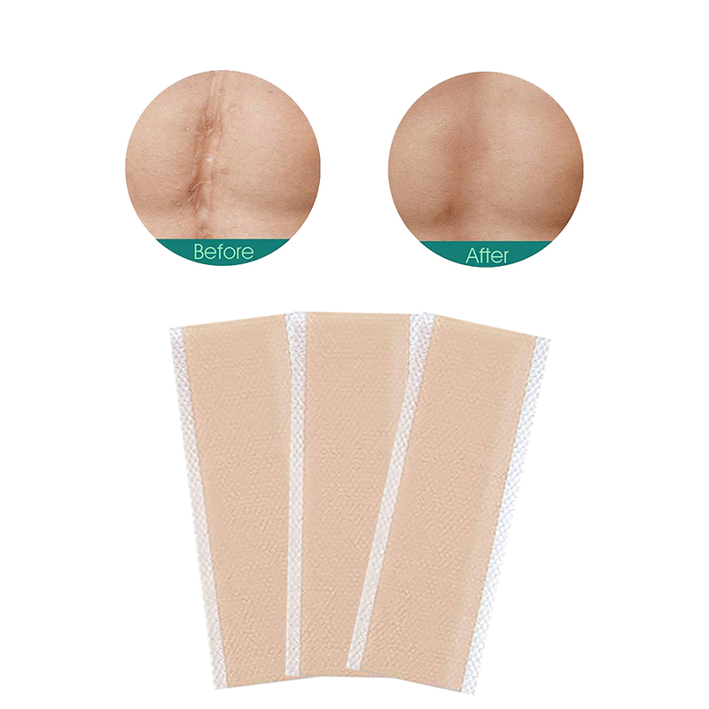 Eco Friendly Silicone Gel Scar Sheet
