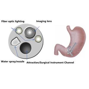 Fórceps de biopsia flexibles portátiles de alta calidad broncoscopia para uso en hospitales de animales - Product Image 5