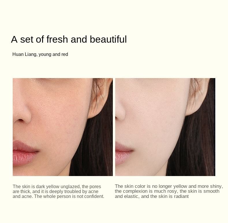 Cosmetics Women's Firming Skin Care Set Herbal Ingredients Facial Essence Yeast Skin Care 5-piece Set Korean Skin Care Products