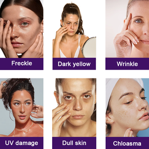 Capsule Sbiancanti per la Pelle ad Azione Rapida in 14 Giorni, <span class=keywords><strong>Booster</strong></span> Puro Illuminante 20000mg, Integratore di L-Glutatione - Product Image 3