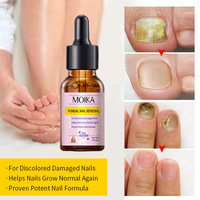 Sérum Réparateur Transfrontalier pour Mycose des Ongles 15ml Glycérine Produit Fortifiant et Stimulant la Croissance des Ongles des Doigts et des Pieds Cosmétiques Commerce Extérieur