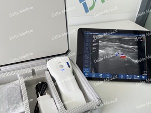 หัวตรวจวัดสัญญาณดอปเปลอร์สีไร้สาย DMU75plus แบบ 3 in 1 คุณภาพคุ้มราคา 192 อีลิเมนต์ 32 ช่องสัญญาณ แบบ Convex Linear Phased Array - Product Image 4