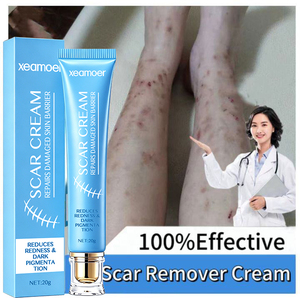 Crème réparatrice <span class=keywords><strong>pour</strong></span> <span class=keywords><strong>les</strong></span> brûlures et <span class=keywords><strong>les</strong></span> <span class=keywords><strong>vergetures</strong></span>, crème anti-cicatrices <span class=keywords><strong>pour</strong></span> <span class=keywords><strong>les</strong></span> anciennes cicatrices, marque privée - Product Image 4