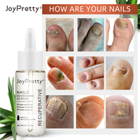 Sérum de traitement des ongles fongiques, soin liquide réparateur des pieds, blanchiment des ongles des pieds, gel anti-infection pour éliminer les champignons des ongles