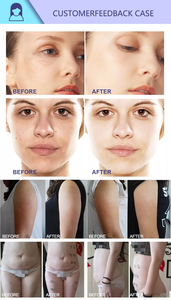 Equipo Profesional de Modelado Corporal para Salón - Elimina la Celulitis, Reduce el Peso, Reafirma la Piel y Contorna el Cuerpo (Venta de Fábrica) - Product Image 2