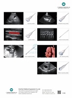C57 4D 5D dernier système de diagnostic à ultrasons Doppler couleur numérique 4D 5D prix compétitif 6 langues échographie portable