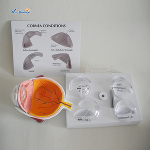 Modelo Médico <span class=keywords><strong>de</strong></span> ojos patológicos <span class=keywords><strong>de</strong></span> Cornea - Product Image 4
