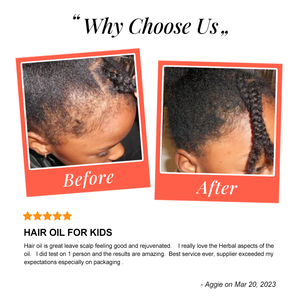 Bé trẻ em sản phẩm chăm sóc tóc thêm sức mạnh phát triển & Nuôi dưỡng trẻ em tăng trưởng tóc phát triển huyết thanh tự nhiên cao cấp Unisex tóc dầu - Product Image 6