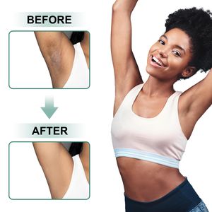 Crema y Loción Correctora de Pigmentación para Aclarar las Manchas Oscuras en el Interior del Muslo y el Bikini - Product Image 3