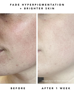 Siero Esfoliante Lenitivo MILKY WAY con 10% <span class=keywords><strong>AHA</strong></span> + Avena, Anti-Rughe, Illuminante, Vegano e Biologico, Marchio Privato - Product Image 5