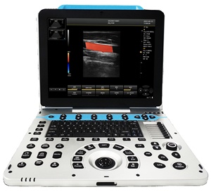 DMSU09 Instrumento de Diagnóstico por Ultrasonido Doppler a Color Portátil para Animales, Escáner de Examen Veterinario por Ultrasonido - Product Image 1