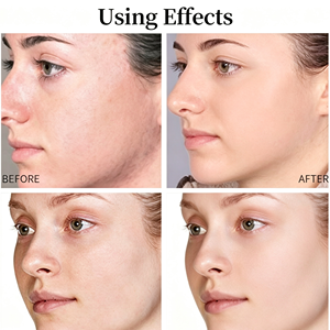 Sérums Faciaux Multi-Types : Rétinol, Arbutine, Vitamines A, B, C, E, Collagène, Acide Hyaluronique – Hydratant, Nourrissant, Essence Visage - Product Image 2