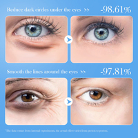 Masque Gel Hydrogel OEM au Lait pour les Yeux, Réduit les Rides, Nourrit, Hydrate, Anti-Cernes et Anti-Poches sous les Yeux