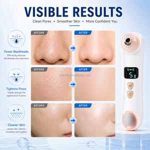 Custom Logo Visual <b>Vacuum</b> Blackhead Remover with Heating Function Adjustable 5 Levels of Suction Power <b>Vacuum</b> Blackhead Removal - Product Image 6