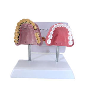 Modelo Anatómico Educativo Médico para Comparación de Dientes Humanos Saludables y con Efectos del Tabaco - Product Image 1