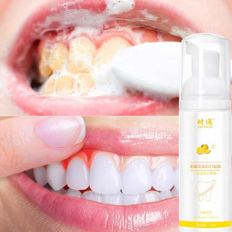 Зубная паста для отбеливания зубов, мусс для гигиены полости рта, удаление пятен, зубной налет, инструмент для чистки зубов, новая версия