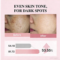 Tonique PDRN Peptides Roses ADN de Rose Complexe 5 Types de Peptides Vitamine C Hydratant Apaisant Éclatant Soin de la Peau Marque Privée