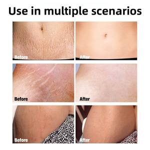 <span class=keywords><strong>Crema</strong></span> Hidratante <span class=keywords><strong>Reafirmante</strong></span> Abdominal con Perlas para Estrías en Adultos y Mujeres Embarazadas - Cuidado Corporal Suave y No Irritante - Product Image 4