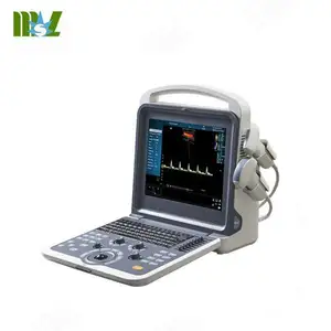 Sistema di imaging ad alta risoluzione scanner ad ultrasuoni a colori intelligente MSLCU62 prezzo della macchina ad ultrasuoni portatile color doppler