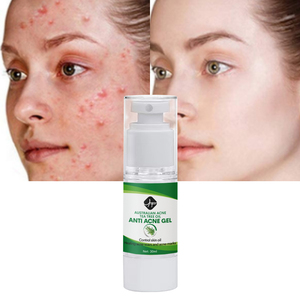 Oem/ODM nhãn hiệu riêng cây trà nổi mụn đốm đen Remover vết sẹo làm sạch sâu mặt chăm sóc da sửa chữa mụn Gel Kem - Product Image 3