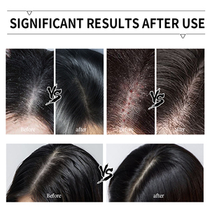 Lozione Esfoliante Vegana OEM per il Cuoio Capelluto, Trattamento Anti-Forfora con Sale Marino, Pulizia Profonda e Purificante, Massaggio per la Cura dei Capelli 2-in-1 - Product Image 6
