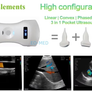Ecógrafo Doppler Color Inalámbrico Portátil de Uso General con Sonda Convexa, Lineal y Cardíaca de 192 Elementos, Escáner Veterinario DCU19G - Product Image 2