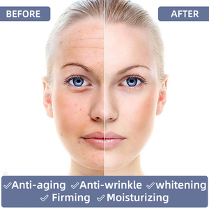 Private Label cosmetici per la cura della pelle Anti Acne crema schiarente coreano acido ialuronico retinolo set per la cura della pelle (nuovo) - Product Image 5