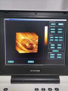 Tragbares Veterinär-Doppler-Sonographer-Hand ultraschall gerät für Wiederkäuer - Product Image 3