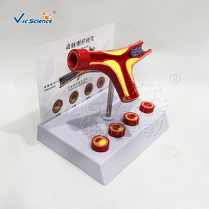 Modèle de vaisseaux sanguins bifurqués hautement réalistes, spécimen anatomique de branches de vaisseaux sanguins, modèle pédagogique pour les écoles de médecine. - Product Image 2