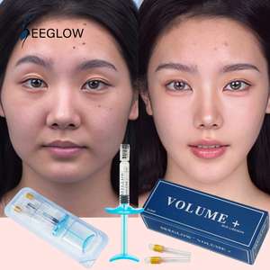 SEEGLOW Ha Gel Iniettabile Reticolato Anti-Età e Sbiancante per Viso, Linea Mascellare, Guance, Mento, Naso, Occhi, Labbra - Filler Dermico all'<span class=keywords><strong>Acido</strong></span> <span class=keywords><strong>Ialuronico</strong></span> - Product Image 6