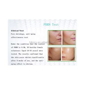 Ampolla Blanqueadora OEM Premium de 5 ml con Ácido Hialurónico Líquido <span class=keywords><strong>para</strong></span> <span class=keywords><strong>Piel</strong></span> Sensible, Reparación, Antienvejecimiento y Antiarrugas Facial - Product Image 3