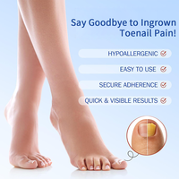 Patchs de Correction d'Ongles de Pieds en Forme de Papillon, Sans Adhésif, Portables, Professionnels et de Haute Qualité (OEM & ODM)