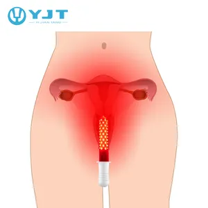 Женское гинекологическое оборудование для снятия боли