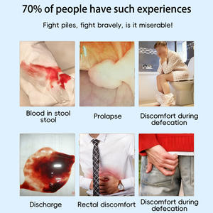 مرهم عشبي طبيعي من المصنع لعلاج البواسير، كريم فعال للبواسير - Product Image 5