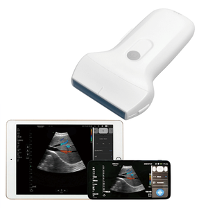 Sonda de ultrasonido inalámbrica para Android, portátil, USB y <span class=keywords><strong>WIFI</strong></span>, a Color - Product Image 1