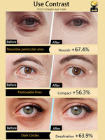 Caviar Collageen Verstevigend Oogmasker Hydraterend Oogmasker Anti-aging Zwellingen Onder De Ogen Donkere Kringen Verwijderaar voor Alle Huidtypen