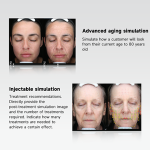 AI Diagnostics Escáner de piel 3D Probador facial Analizador de piel para estética - Product Image 3
