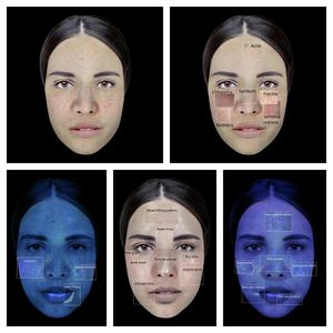 Taşınabilir 3D yüz cilt analiz makinesi tarayıcı BV cilt analiz cihazı bir ağ bağlantısına ihtiyaç duymaz - Product Image 6