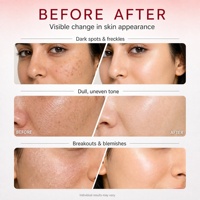 Crème éclaircissante anti-taches TWG RTS à l'acide kojique, crème anti-acné, éliminateur de taches brunes, crème hydratante et éclaircissante pour le visage à l'acide kojique