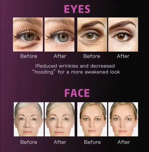 Prix Usine Nouveau Système de Refroidissement Beauté à l'Azote 5ème Génération Expert Lifting Visage Anti-Rides Écran TFT 8 Pouces Compatible US - Product Image 4