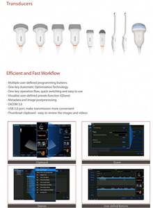 Máquina veterinaria Ecografo portátil de alta resolución Echographie 3D 4d Color <span class=keywords><strong>Doopler</strong></span> para ganado - Product Image 4