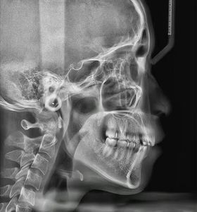 Máquina de Tomografía Computarizada <span class=keywords><strong>Dental</strong></span> de Segunda Mano, Soporte para Video/Inspección en Sitio, Opción Rentable, Imágenes de Ultra Alta Definición - Product Image 4