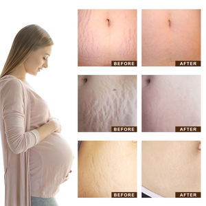 Gel Riparatore <span class=keywords><strong>per</strong></span> Macchie Scure e <span class=keywords><strong>Cicatrici</strong></span> <span class=keywords><strong>da</strong></span> Acne di Alta Qualità OEM, <span class=keywords><strong>Crema</strong></span> <span class=keywords><strong>per</strong></span> Rimozione <span class=keywords><strong>Cicatrici</strong></span> <span class=keywords><strong>da</strong></span> Ustioni - Product Image 4