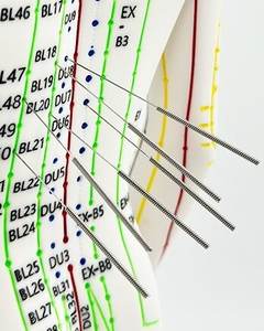 स आईएसओ प्रमाणित कोडित एक्यूपंक्चर बिंदु मॉडल पुरुष महिला व्यावहारिक टीसेमी जो मानव शरीर एक्यूपंक्चर प्रशिक्षण उपकरण - Product Image 5